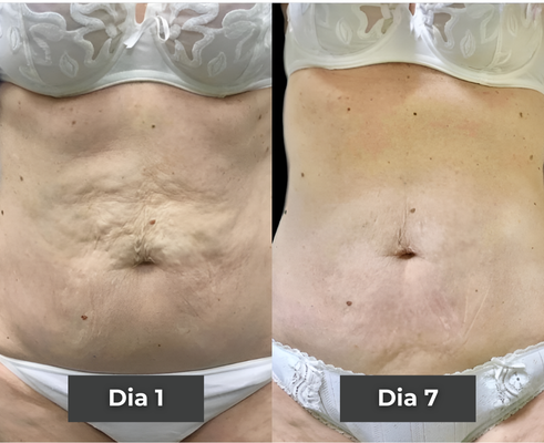 Before and after comparison