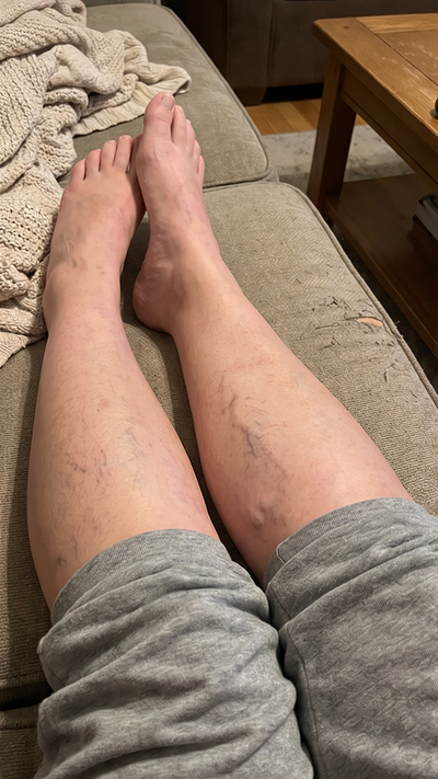 Before - Daniel