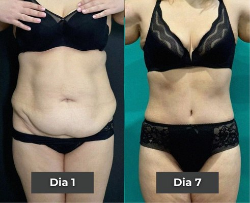 Before and after comparison