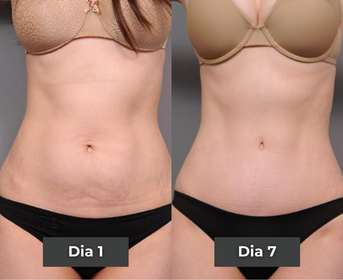 Before and after comparison