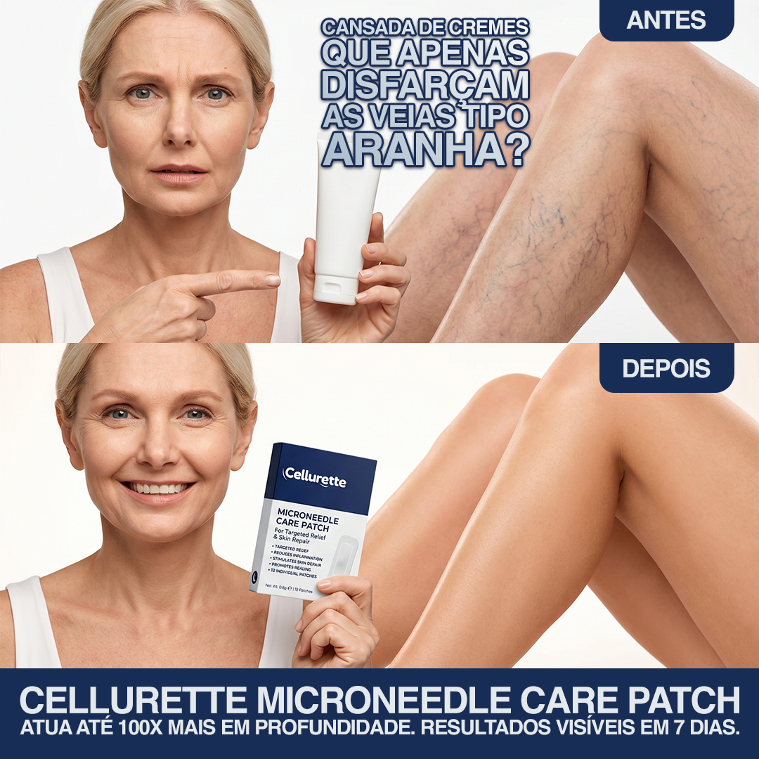 Adesivo de microagulhas Cellurette