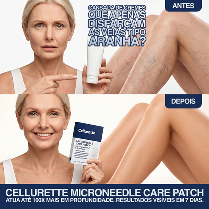 Adesivo de microagulhas Cellurette